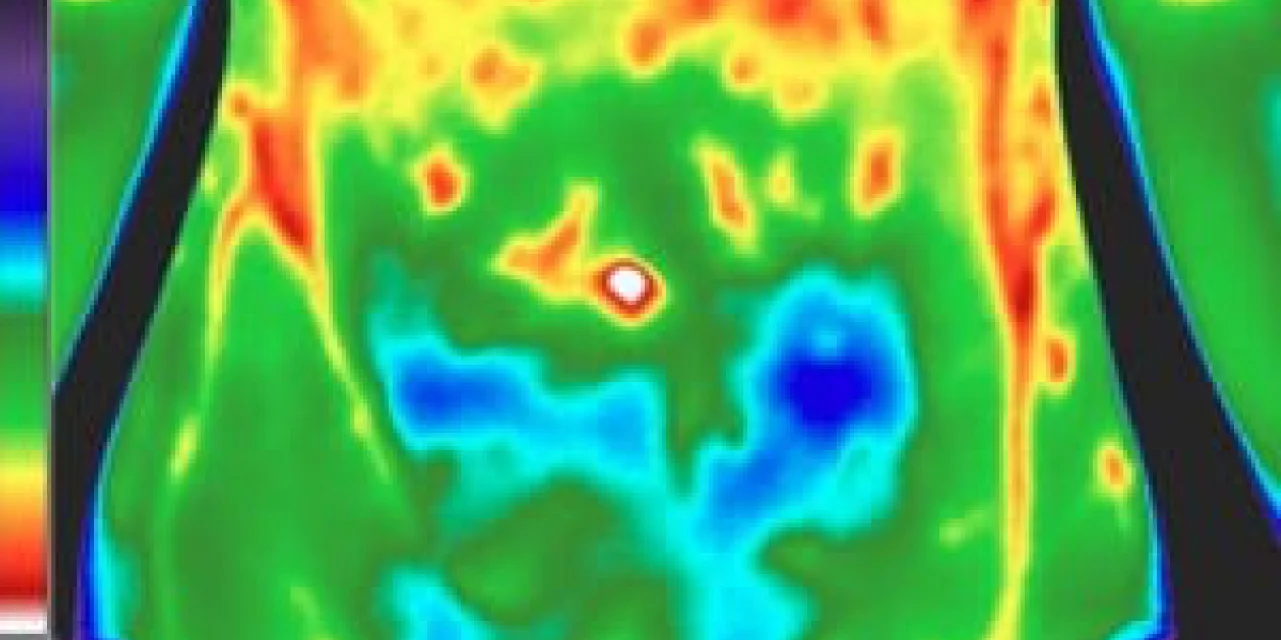A thermal image of a torso, with cooler blue regions against warmer green and red.