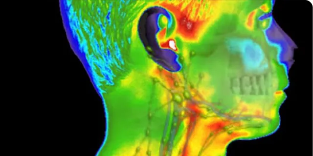 A thermal image of a head and neck in profile.