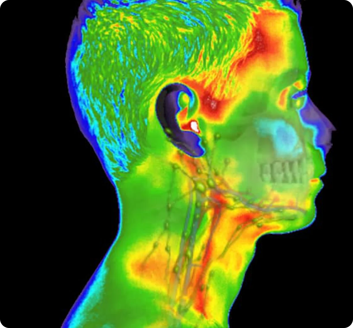 A thermal image of a pair of legs beside the camera's temperature scale, mapping surface temperature from blue through green to red.